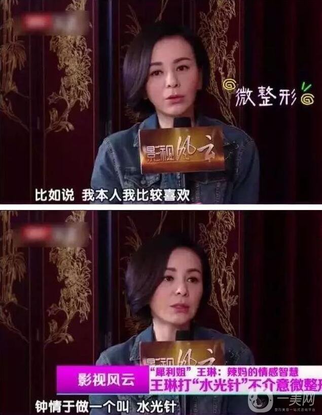 為什么眾多明星都鐘愛*？