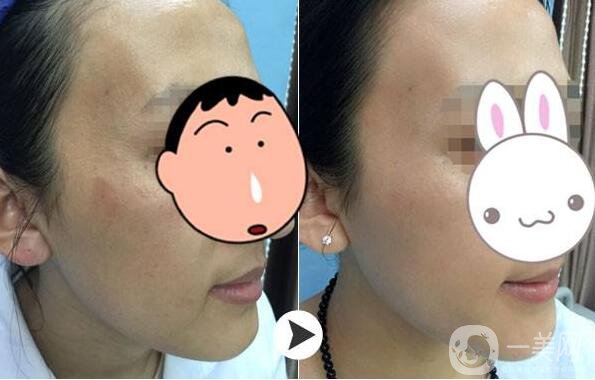 為什么眾多明星都鐘愛*？