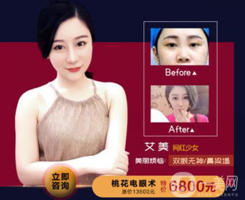 佛山夢(mèng)露整形醫(yī)院跨年狂歡月 積贊當(dāng)錢花