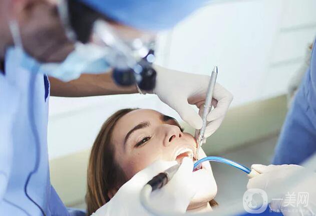 烤瓷牙多久換一次比較好呢？