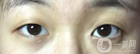 整容整得好看是怎樣一種體驗？眾知乎美女回答讓你羨慕嫉妒恨！