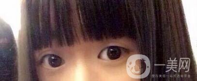 整容整得好看是怎樣一種體驗？眾知乎美女回答讓你羨慕嫉妒恨！