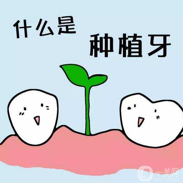 北京種植牙多少錢,北京種植牙介紹