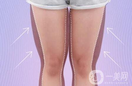 大腿吸脂多久恢復(fù),大腿吸脂*嗎