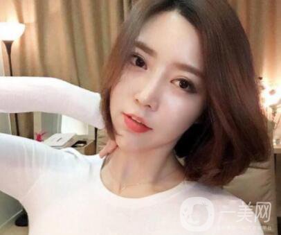 印度班加羅爾下巴整容手術(shù)費用 頜骨整容手術(shù)*果