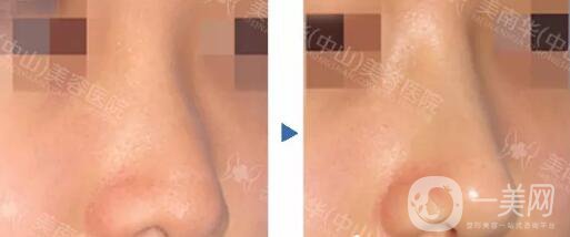 中山美南華醫(yī)院怎么樣 優(yōu)惠整形價格表一覽