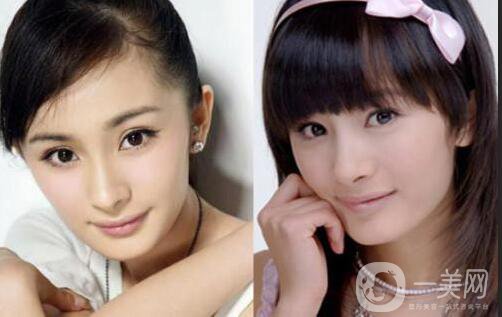 又一個整容失敗的女明星，鼻子都整歪了，不甘心揚言還要植發(fā)！