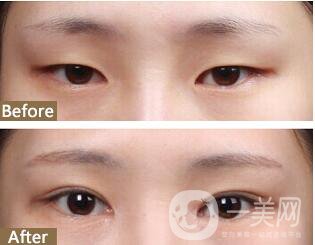 溫州藝星醫(yī)學(xué)美容醫(yī)院