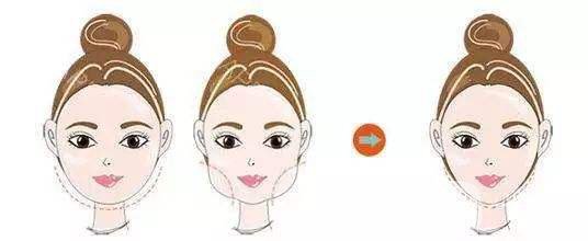 深圳做個臉部抽脂多少錢 *果好不好