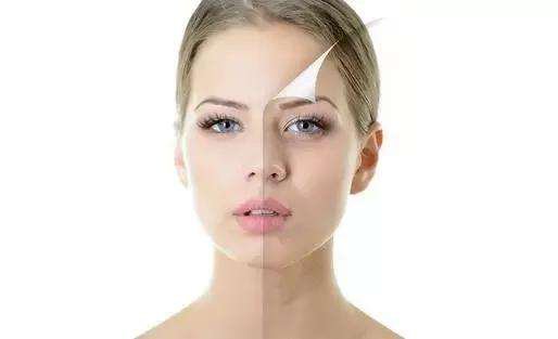 彩光嫩膚的危害 彩光嫩膚的優(yōu)勢