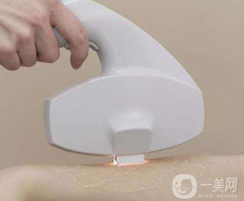 關于激光脫毛的常見問題解答