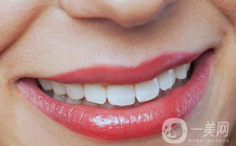 做牙齒矯正腫脹如何消腫 牙齒矯正的*佳年齡