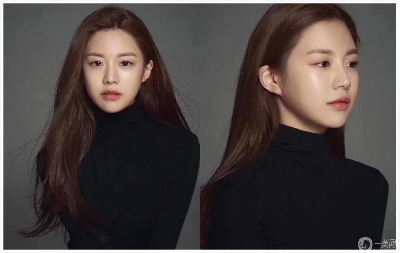 重慶做雙眼皮要多少錢 割雙眼皮喲風(fēng)險嗎