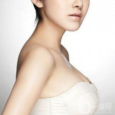 隆胸后出現(xiàn)哪些情況需要做修復？