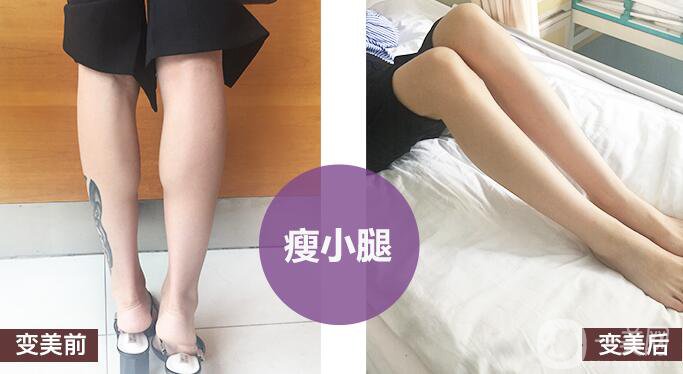 打*有副作用嗎？都有哪些副作用呢？