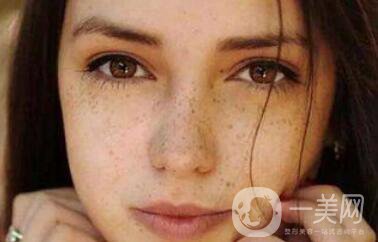 紅寶石激光祛斑*果,紅寶石激光祛斑術(shù)后注意事項(xiàng)