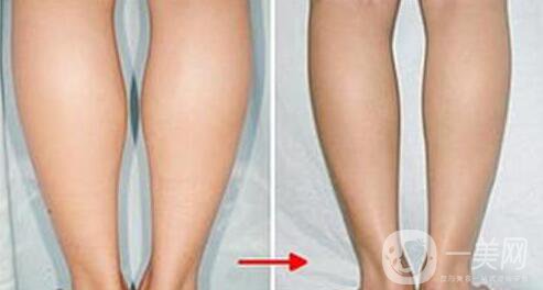 打*多少錢,*價格