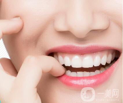 哪種烤瓷牙比較好？他們有什么區(qū)別呢？