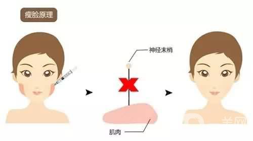 *一針要多少錢 *的藥*是*的嗎