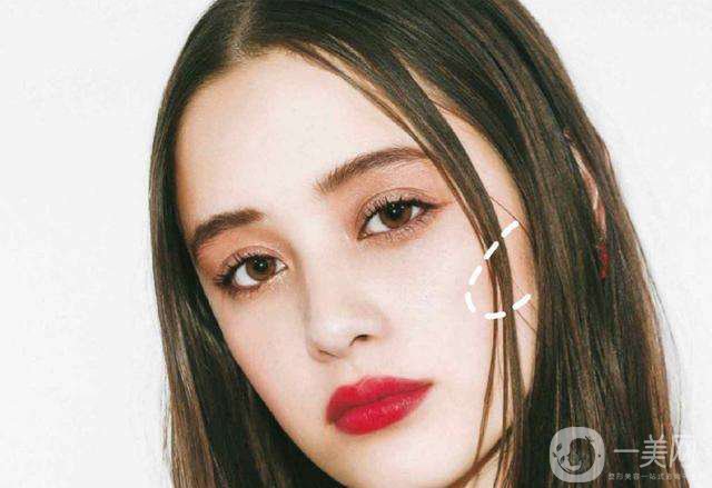 削骨要多少錢 削骨*果好不好