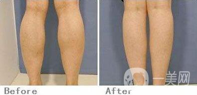 *會(huì)反彈嗎 *的*果怎么樣