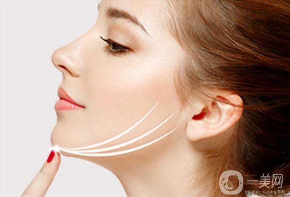 自體脂肪能墊下巴嗎？*果如何？會不會很貴？