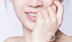 做整容手術(shù)是你2019計(jì)劃的一部分嗎?