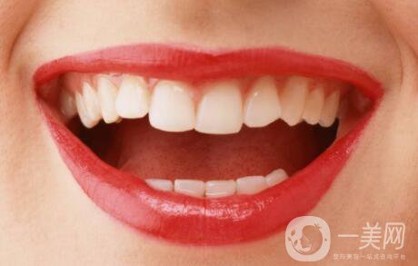 種植牙的過(guò)程 種植牙齒的種類(lèi)有哪些？