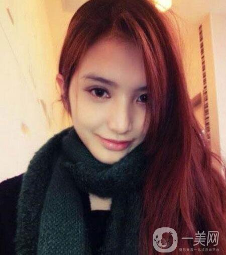 下頜整形手術(shù)的方法有哪些？