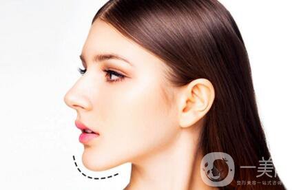 自體脂肪墊下巴恢復(fù)期是怎樣的？如何做好術(shù)后護(hù)理？