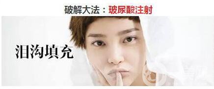 玻尿酸填充淚溝的危害 *果怎么樣