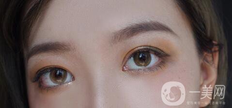 上海九院開眼角價格|*果測評