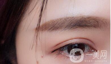 上海九院開眼角價格|*果測評