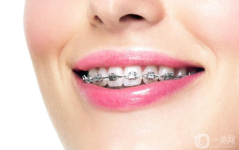 天包地怎么慢慢矯正 天包地是怎么產(chǎn)生的？