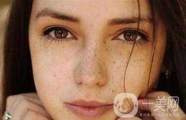 祛斑價格,祛斑貴不貴