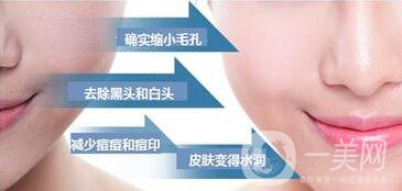 黑臉娃娃價格表,成都黑臉娃娃報價