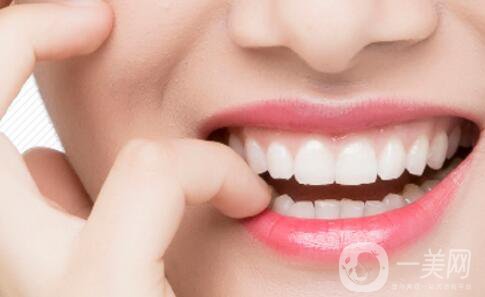 烤瓷牙種類及價(jià)格介紹 烤瓷牙貴嗎？