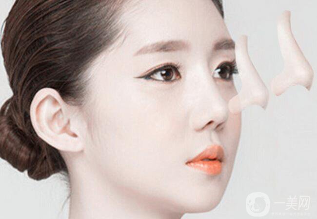 隆鼻哪種好 該如何選擇適合自己的方式？