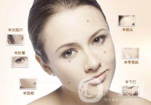 自體脂肪面部填充貴嗎