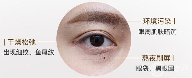 調(diào)節(jié)魚尾紋的方法有哪些 哪種比較適合你？