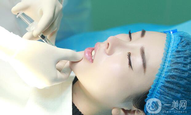 自體脂肪墊下巴貴嗎 一般多少錢？