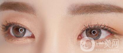 玻尿酸豐臥蠶貴嗎 價(jià)格是多少？