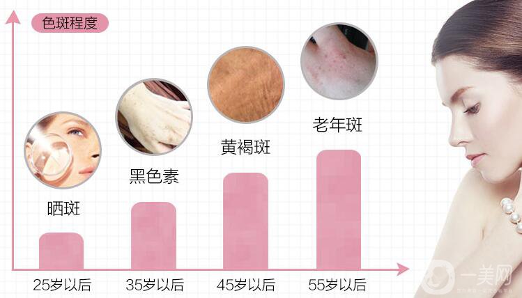 如何調(diào)節(jié)老年斑 都有哪些方式呢？