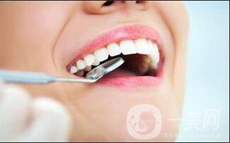 皓齒美白牙齒多少錢,皓齒美白牙齒費(fèi)用分析