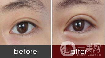 北京豐臥蠶貴嗎,北京豐臥蠶多少錢