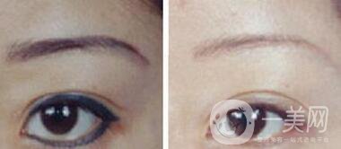 洗眼線多少錢,洗眼線價(jià)格