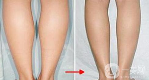 打*多少錢,*價(jià)格盤點(diǎn)