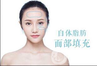 面部自體脂肪填充貴嗎,面部自體脂肪填充多少錢