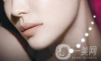 膨體墊下巴貴嗎