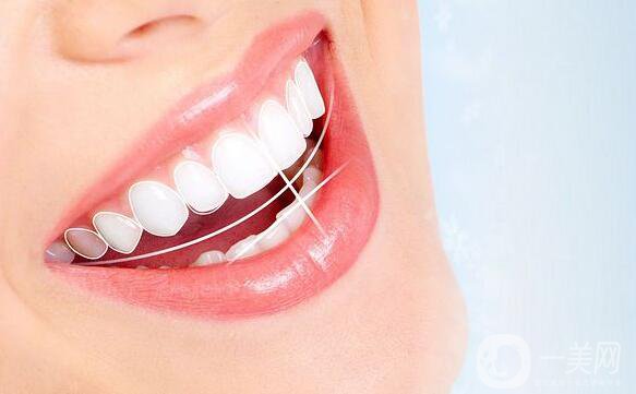 噴砂洗牙原理是怎樣的呢 *果好不好？